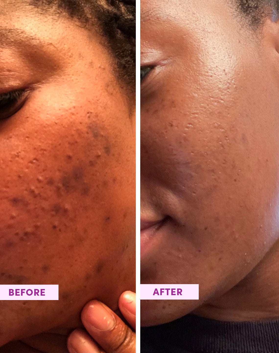 Australian Glow Berries Enzyme Powder Polish